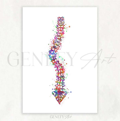 Spine with Scoliosis Watercolour Print